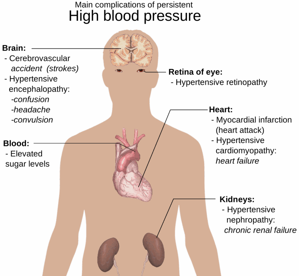 découvrez tout sur l'hypertension : causes, symptômes, risques et traitements. apprenez comment gérer votre pression artérielle pour une vie plus saine et prévenir les complications liées à cette affection courante.
