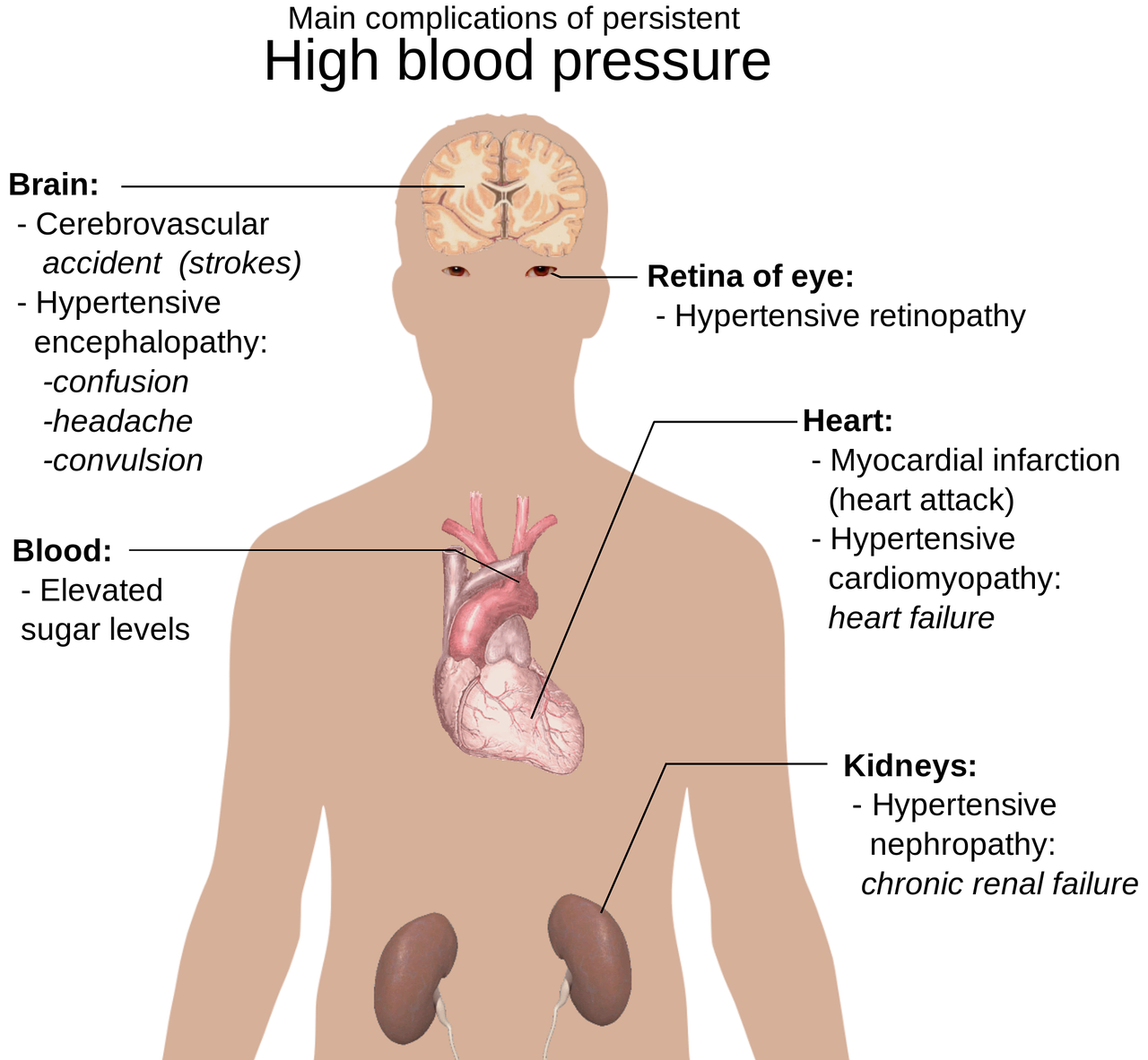 You are currently viewing Comment savoir si l’on fait de l’hypertension sans appareil ?